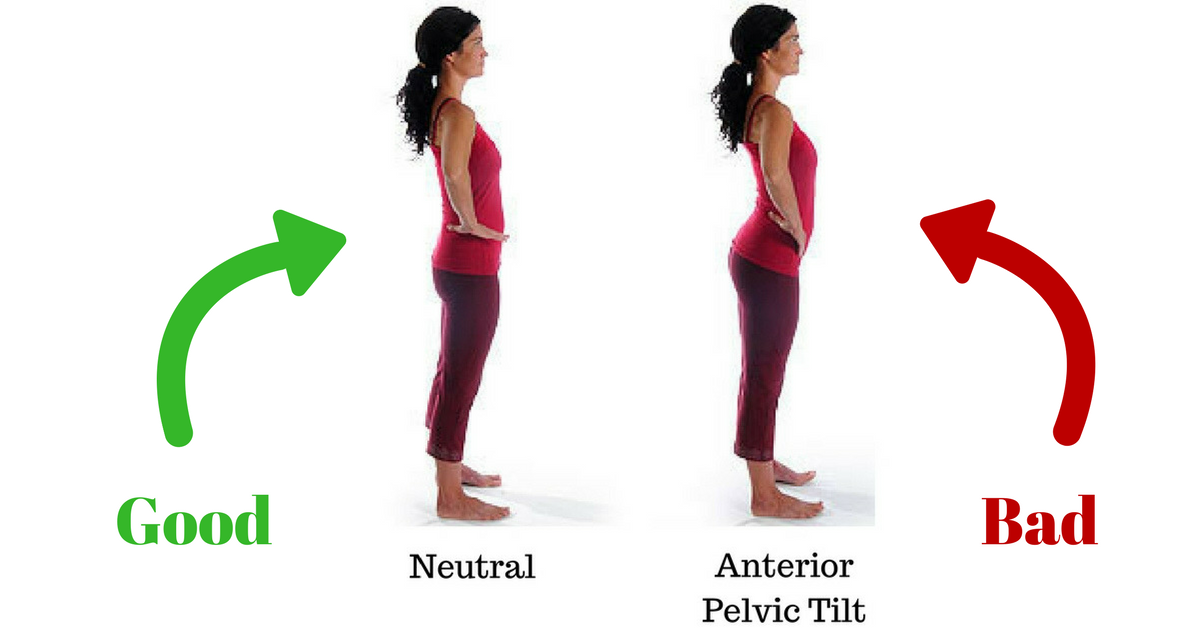 假翹臂是盤骨前傾其中一個表徵,盤骨前傾(Anterior pelvic tilt)是常見的病患情況,不分性別,年齡或職業,都有機會有患上盤骨前傾。 假翹臂是盤骨前傾其中一個表徵,盤骨前傾(Anterior pelvic tilt)是常見的病患情況,不分性別,年齡或職業,都有機會有患上盤骨前傾。