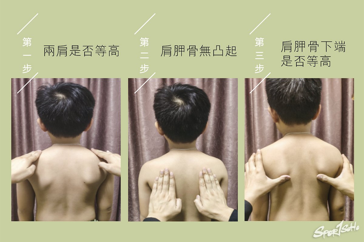 親子小運動 護脊大作用|中醫卷