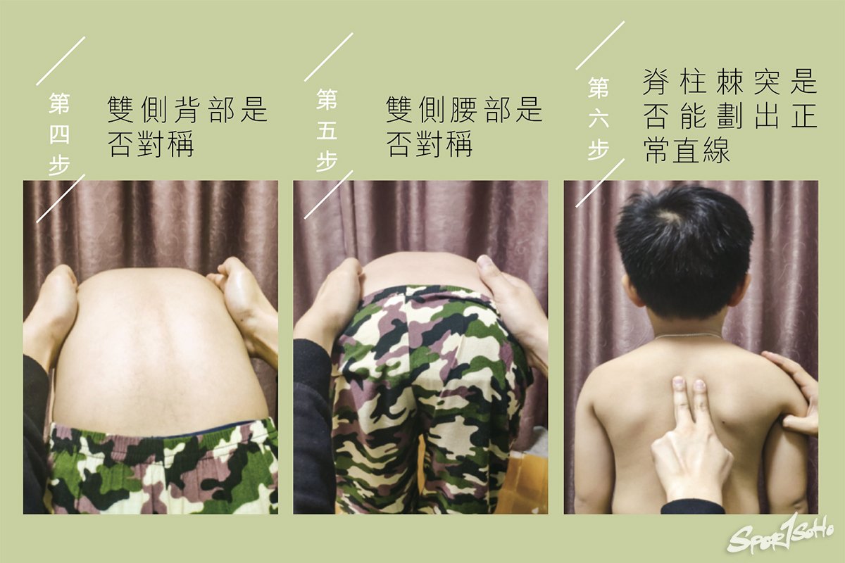 親子小運動 護脊大作用|中醫卷